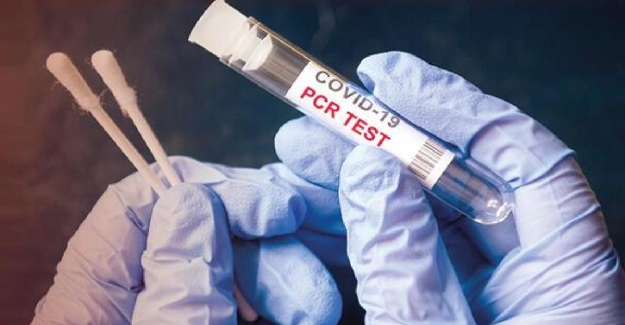 Korona Geçirdikten Sonra PCR Testi Devam Ediyor mu?