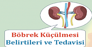 Böbrek Küçülmesi Nedir? Böbrek Küçülmesi Belirtileri Neler?